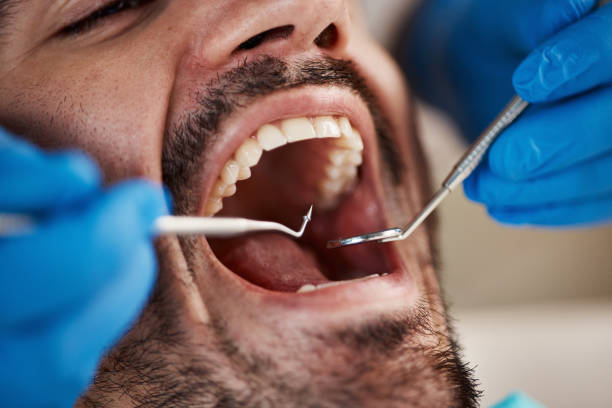 Best Broken Tooth Emergency  in Silver Lake, KS